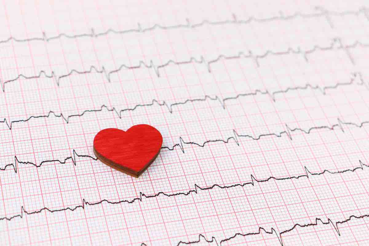 Ecg via wi fi